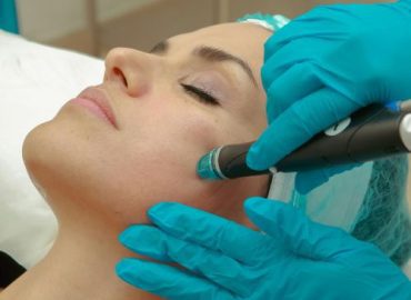 Dermal Needling Dermal Needling