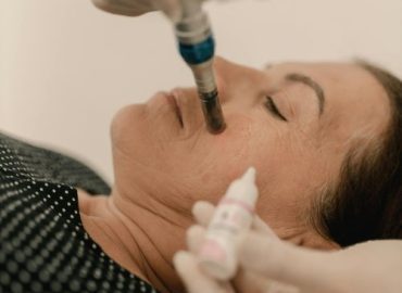 Micro-Dermabrasion Micro-Dermabrasion