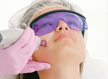 Skin Tags Removal Skin Tags Removal